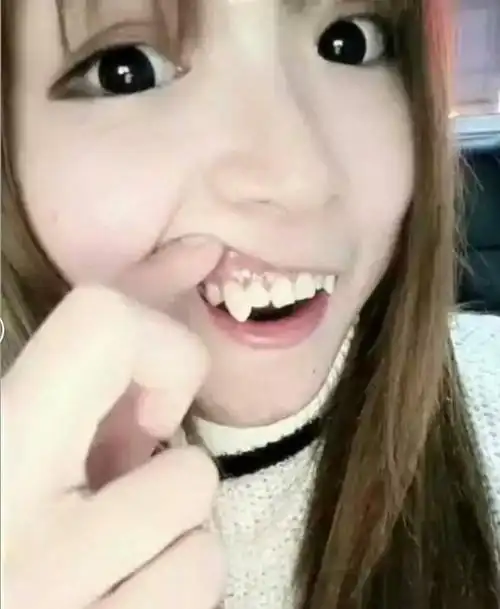 很多人想拔掉虎牙 为什么医生坚决不同意?