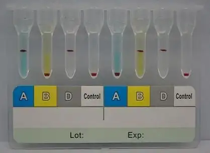 微柱凝胶卡法在血型检测中的应用