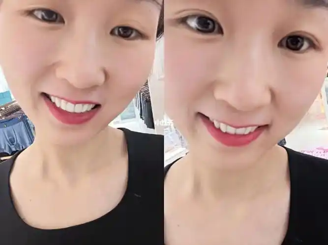 我的双眼皮单眼皮对比欢迎点评