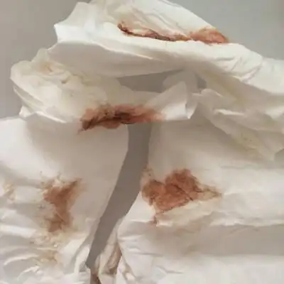 宝妈们,见红的血是咖啡色吗?