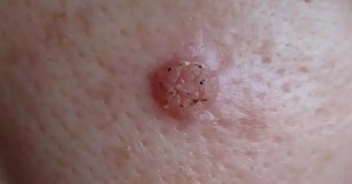 刺瘊瘊子休子是什么鬼