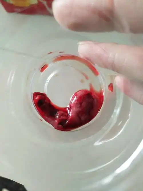 怀孕了不想要孩子,医院给开了打胎药 今天这流出来的是不是孕囊? 急!