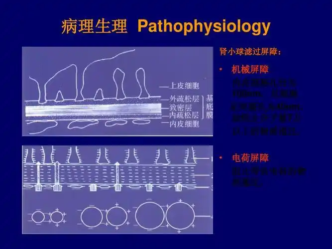 肾病综合征病理图片ppt 病理生理 pathophysiology 肾小球滤过屏障