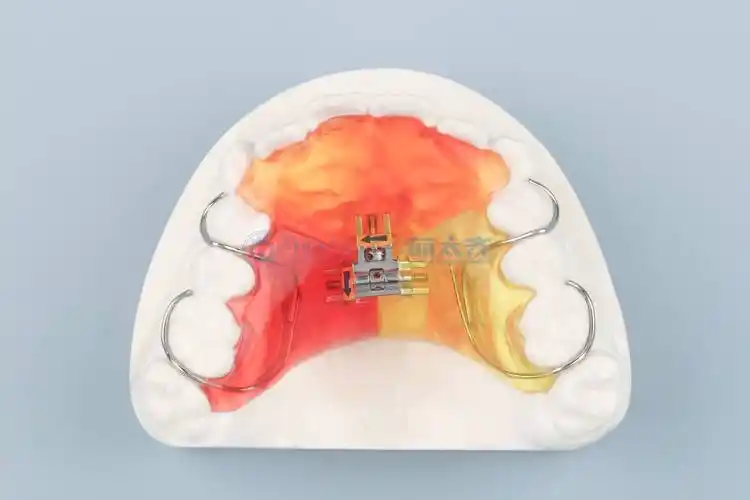 早期矫治对小孩口腔健康有哪些好处