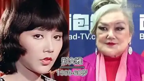 10大整容女星对比,没有最丑只有更丑,邵音音张檬简直惨不忍睹!