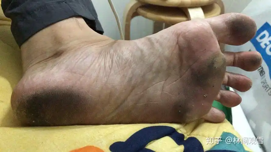 拥有一双好看的脚是一种什么样的体验