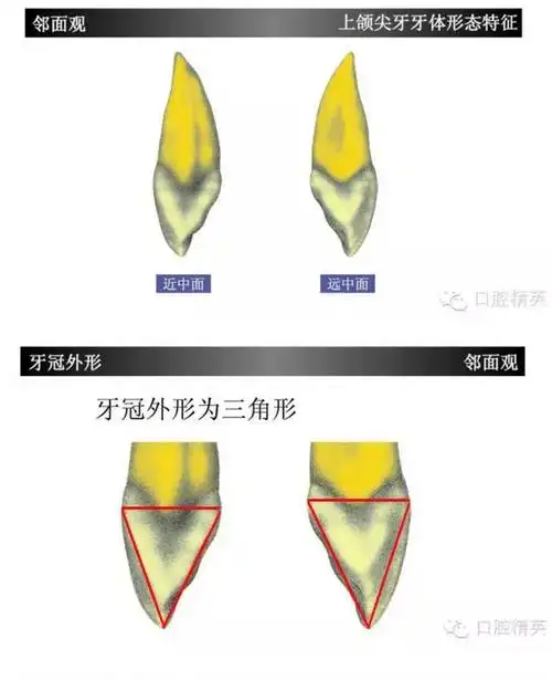 上颌尖牙(上3)如此复杂?学习了