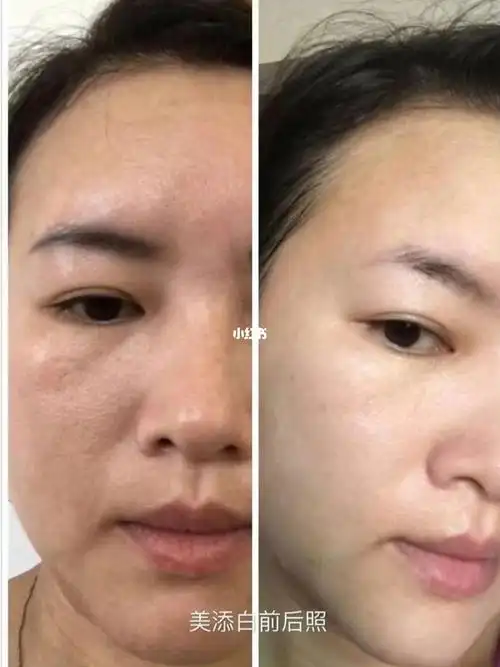 每天补充胶原蛋白,皮肤美白细腻,抗衰老_胶原蛋白_抗衰老_美白_胶原