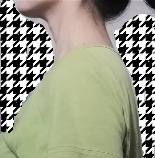 姐妹们怎么改变脖子前倾啊