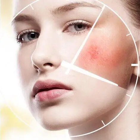 【问题型肌肤课堂——敏感肌】99 敏感皮肤的人特别苦_圈子-新氧