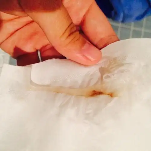 已经进入排卵期了,还没到排卵日,可今天早晚都有拉丝,还有血丝.