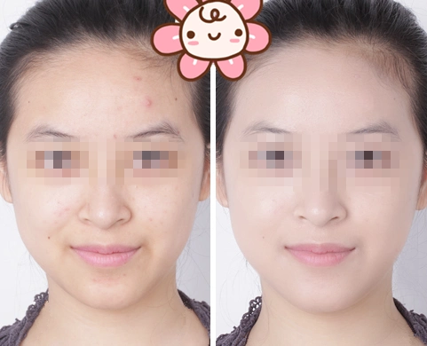 给大家参考下楼主上妆前后的对比效果