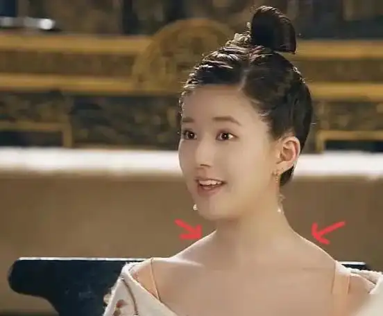 而且赵露思的斜方肌也很大,斜方肌太发达就会导致溜肩,让脖子看起来短