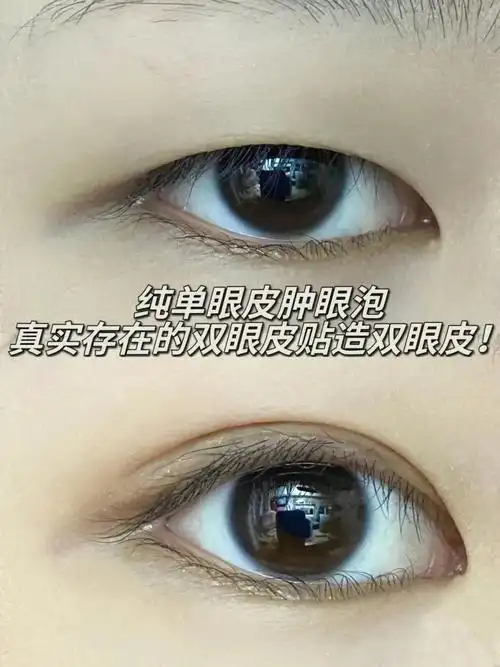 发现了裸眼更加隐形的双眼皮贴颜色和肤色几乎一样疫情在家不出门贴个