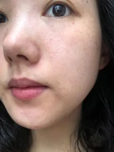 0                                  脸上的色斑有些多,皮肤也有些