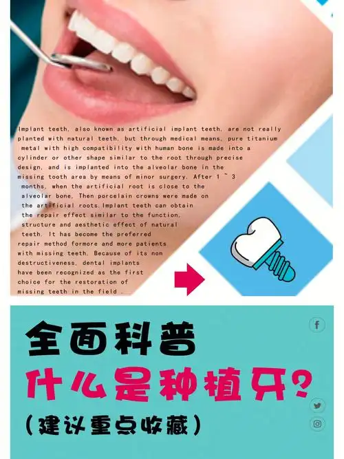 全面科普什么是种植牙71