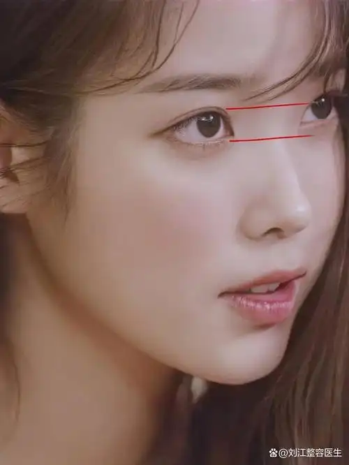 塌鼻子并非不好看,她打破了这世俗的认知!塌鼻子美女代表——iu