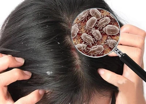 美神床垫头发越掉越多别慌可能是螨虫在作怪