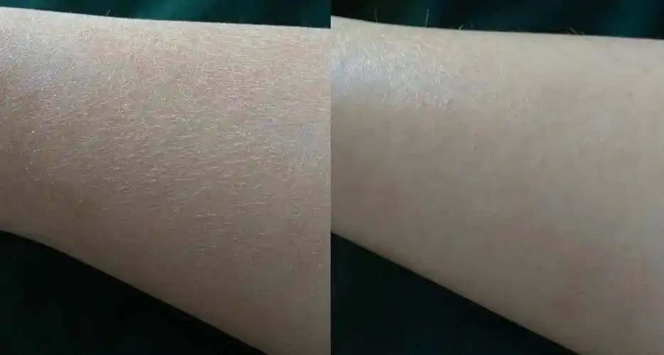 皮肤干到起皮一篇教你选到保湿不粘腻的身体乳