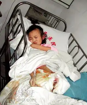 图:小冯宇永远失去了双腿.(fish/编制)