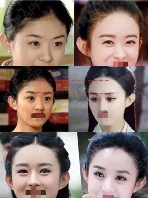 赵丽颖的圆发际线是天生的吗