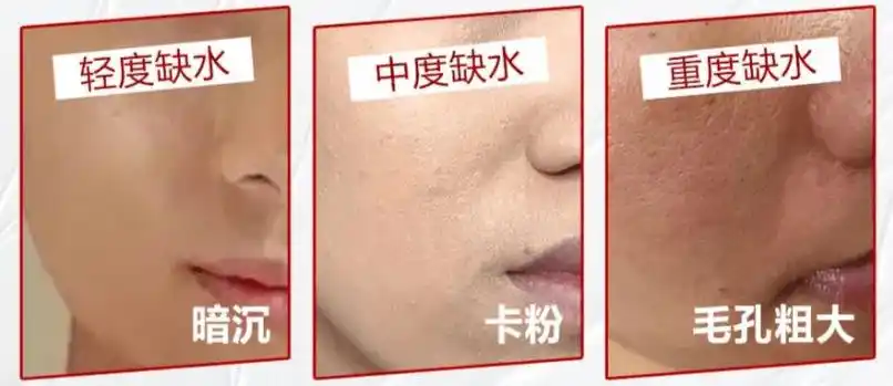 缺水程度自测,你的皮肤有多渴?_丁叔