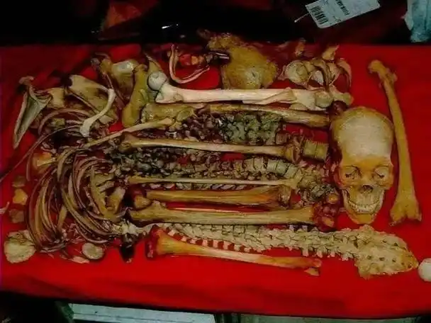 瑞典女子有恋尸癖藏6具尸体初夜也是和骷髅