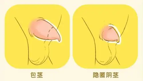 小心耽误孩子男宝蛋蛋出现这几种情况要重视越早检查越好