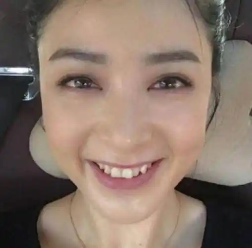 李沁牙齿变白了?