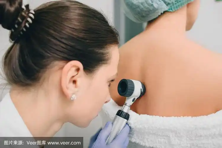 皮肤科医生用皮镜检查病人皮肤上的胎记