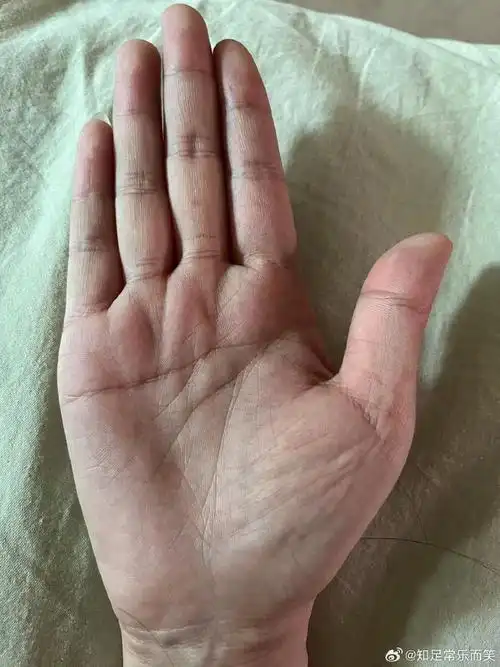 手相看生命线不大好,多注意检查身体,从智慧线来看,你头脑非常聪明