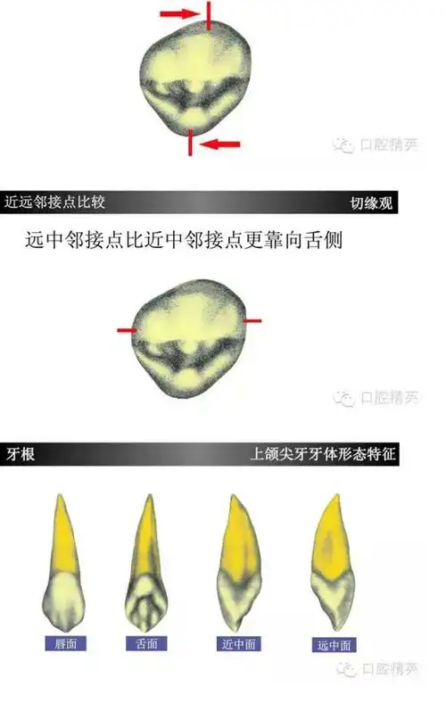 上颌尖牙(上3)如此复杂?学习了