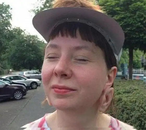 女子长出三个耳朵六个手指相貌恐怖,而背后真相让人惊讶不已