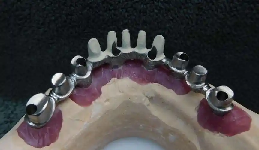 内连接螺丝固位型桥架