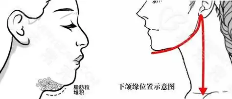 下颌缘示意图