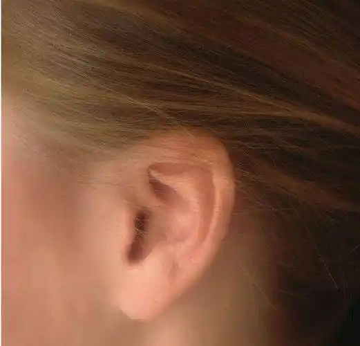 原创心理测试下面四只耳朵最有福气是哪只看你天生是富贵命吗