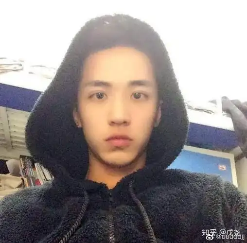 许魏洲眼睛肌无力割双眼皮前照