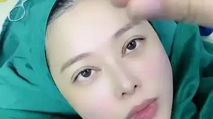 芭比眼 眼综合,平行双眼皮,好看吗