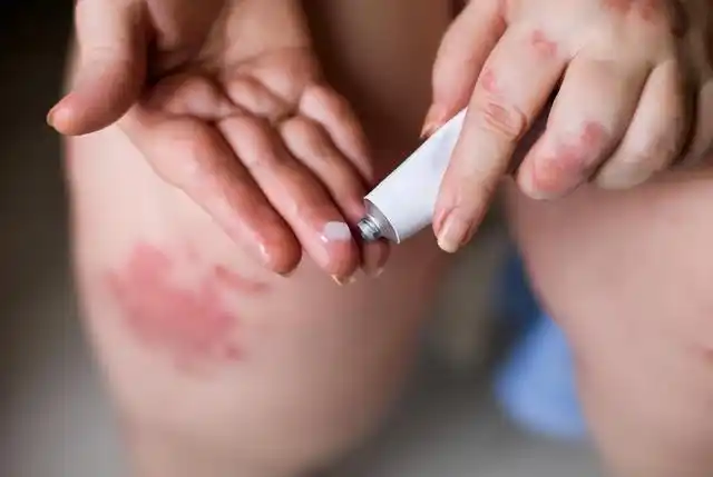 建议了解一下|过敏|眼膏|药膏_网易订阅