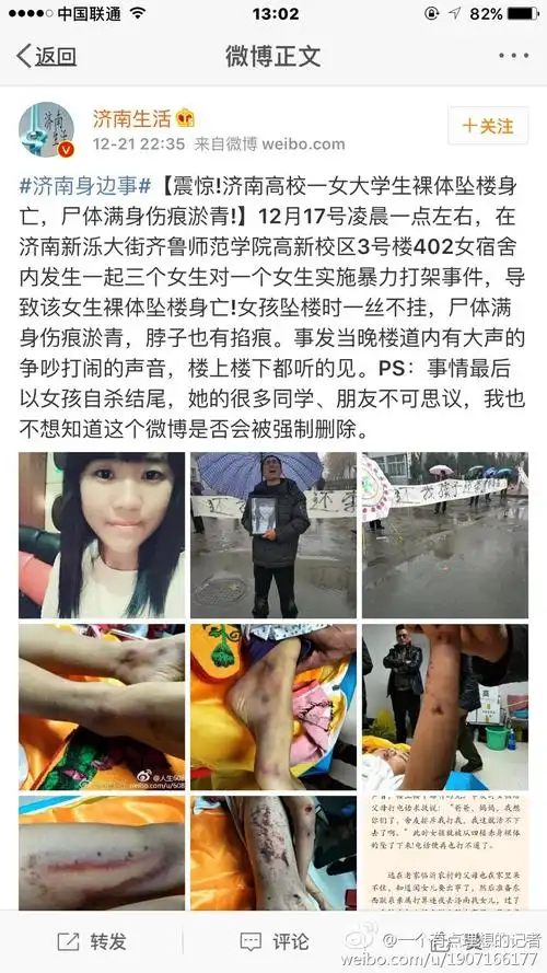 齐鲁师范学院女生坠楼伤痕,公安部法医告诉你是否室友殴打导致.
