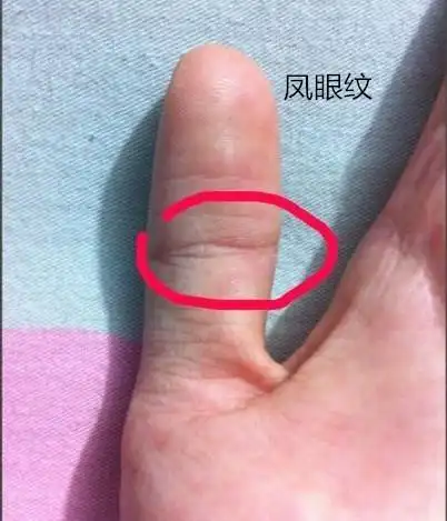 大拇指有凤眼的女生