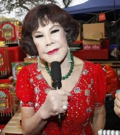 整容失败的十个女星(8位整容失败的女星)(28)