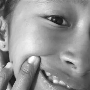 12岁外甥长了虎牙 拔还是不拔? 急死人了