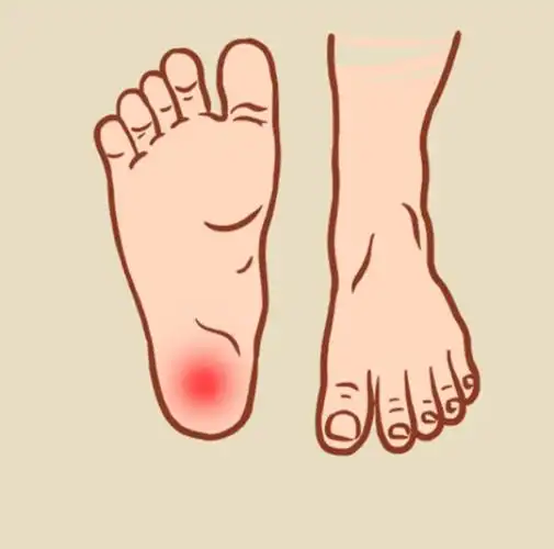 大夫我的脚后跟有点疼是不是肾虚