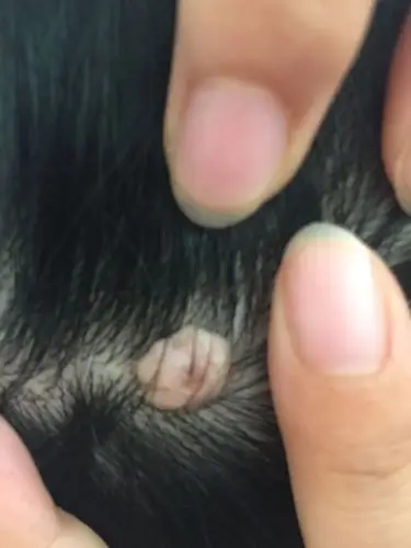 头皮上长了个疙瘩将近二十年了 不疼不痒 求解这是什么原因呢