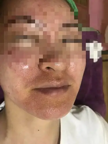 "我在这家美容店花了2392元购买了4瓶修复霜.