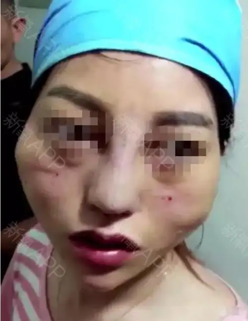 她是我见过整得最最最失败的人,没有之一!