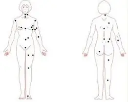 有这颗痣的人一生逍遥自在 女性后背痣大解析