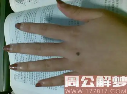 手背痣相图解手背长痣代表什么