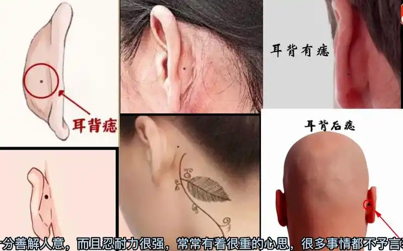 麻衣看相识人"耳朵背后有痣"!